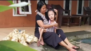 Siti Aminah dan Vira Sang Buah Hati Pengidap Hidrosefalus